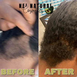 GROW DRIP (Hair Oil)