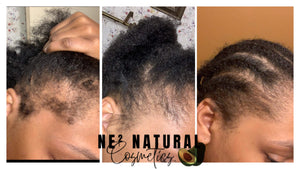 GROW DRIP (Hair Oil)